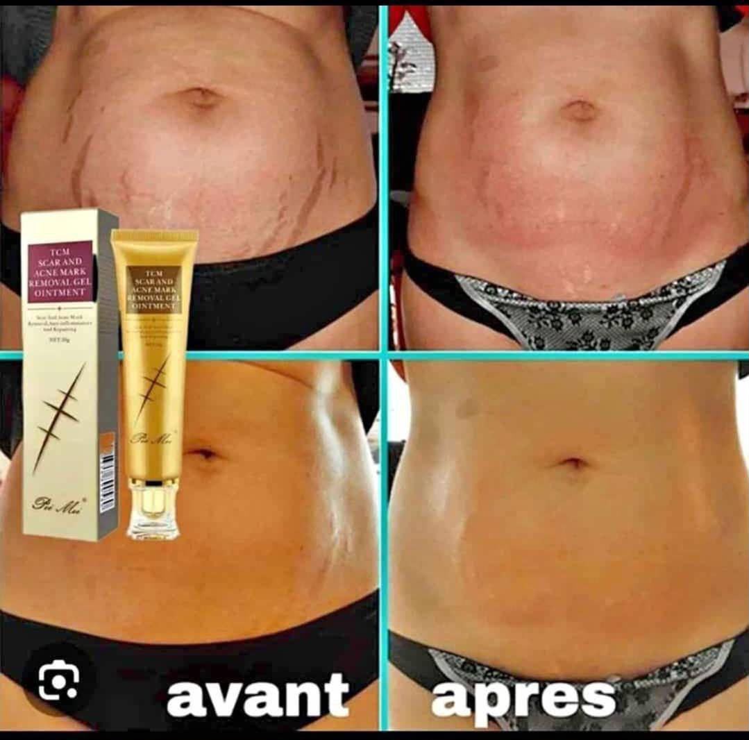 Creme cicatrisante